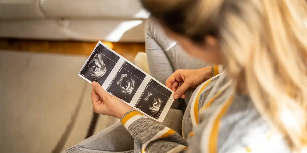 pregnant woman holding sonogram