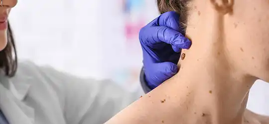 doctor inspecting mole on paitent's neck