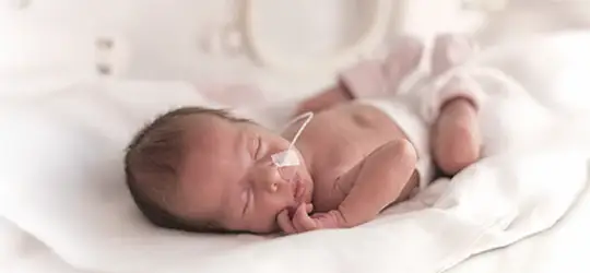 baby with oxygen tube